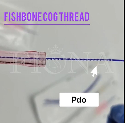 Fishbone Vormende Radertjedraad