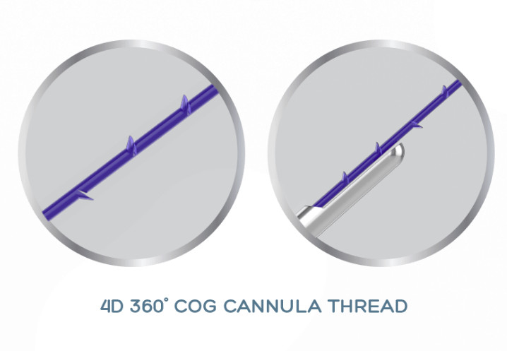 Van het RADERTJEcannulla van PDO PCL PLLA 4D de Draadlift 19G100mm voor niet het Chirurgische Gezicht Opheffen